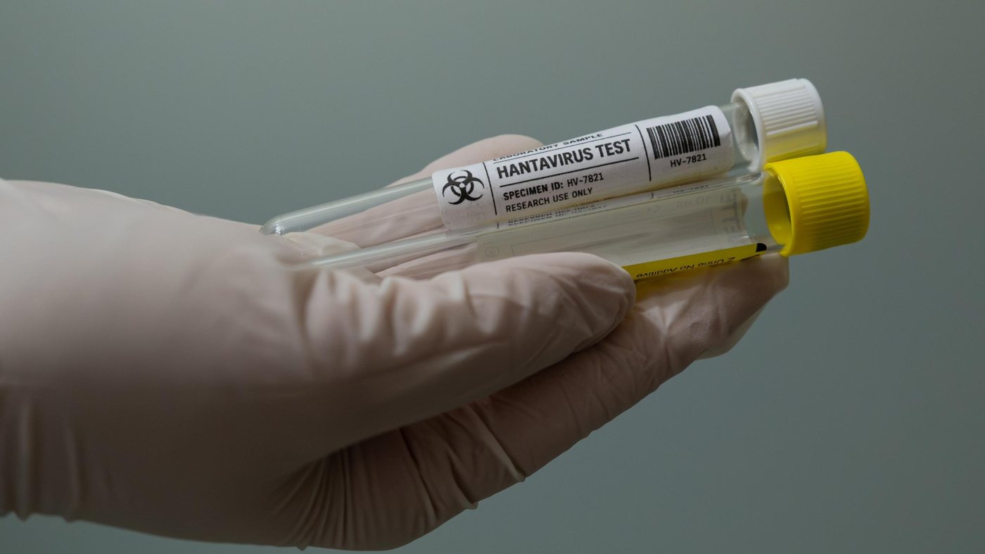 Un cas d'hantavirus détecté chez un touriste ayant séjourné en France en juillet, annonce le ministère de la Santé